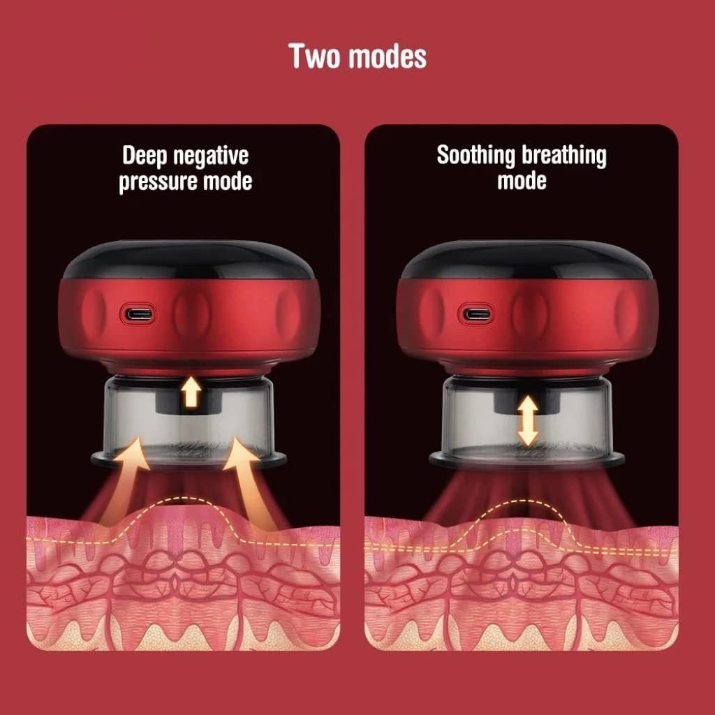 Electric Cupping Therapy Set with 6 Level Temperature and Suction for Back | Delivery: 2 to 3 business days | Limited stocks available | Hurry before Sold Out